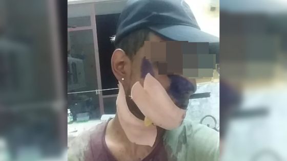 Salim : «Zot inn pik mwa dan mo lerin, dan mo lagorz»