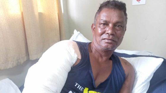 Sanjay Bissoo, rescapé admis à la Burns Unit : «J’ai ressenti une forte brûlure et je me suis évanoui» 