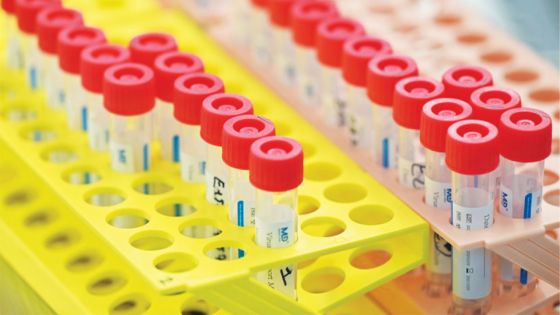 Séquençage : par manque de moyens, Maurice est loin du compte