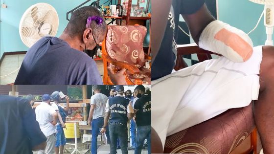 L’homme qui a eu un poignet sectionné se confie 