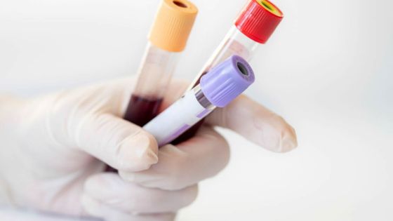 Alan Ganoo : «Choqué par les analyses sanguines sur les automobilistes»