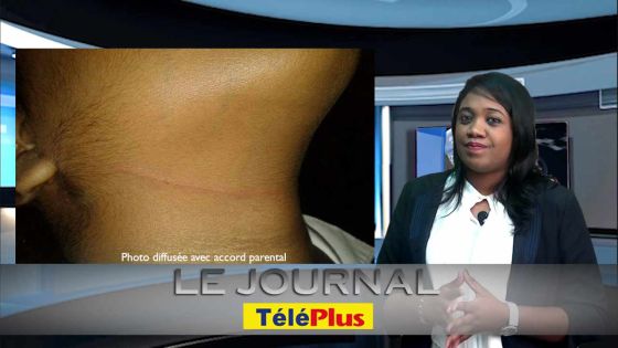 Le Journal TéléPlus – Au collège Patten : un élève tente d’étrangler un autre élève de 12 ans avec un câble électrique