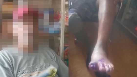 Quartier-Militaire : un commerçant sauvé par son épouse qui fait fuir deux voleurs