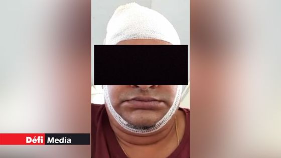 Agression à Vacoas lié à un conflit autour d’un passage commun : un sexagénaire lance des pots de fleurs sur la tête d’un père de famille