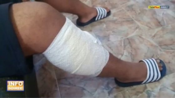 Un collégien de 15 ans agressé au cutter : «Enn garson inn koup mo lipie 3 fwa»