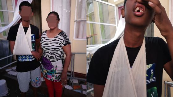 Violence dans un collège de Port-Louis 