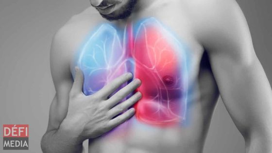 Corona : le virus en rapide prolifération en Asie de l’Est et sud-est