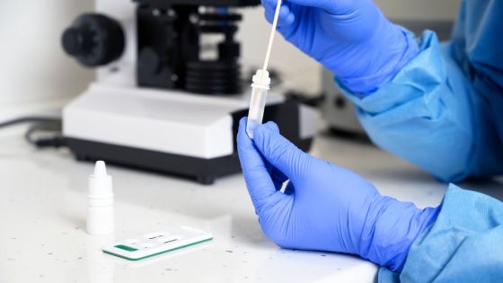 Covid-19 : le ministère de la Santé surveille de près le nouveau sous-variant d’Omicron EG.5