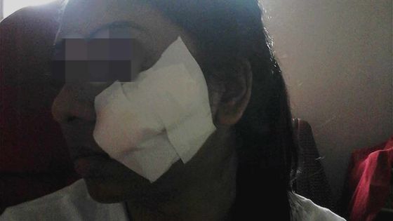 Tailladée au visage - Nisha: «Mo ex ti menas pou fer sa kan nou finn separe»