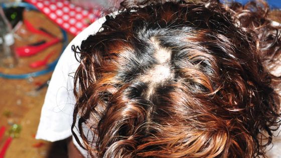 Soupçons d’infidélité: elle est menacée de mort et a les cheveux arrachés