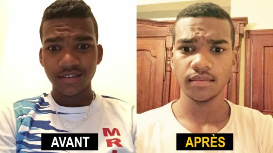 Aaron expulsé de l’école à cause de ses cheveux