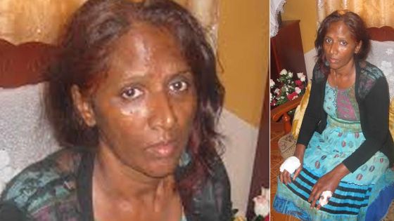 Une mère et sa fille agressées dans leur snack