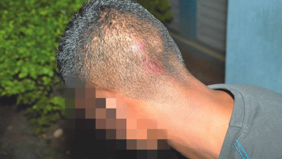 Liaison avec l’épouse de son patron: Fadil est agressé et perd son job