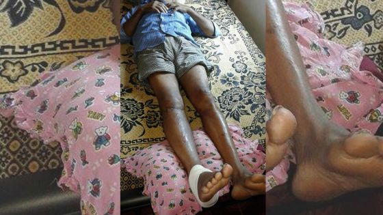 Victime d’un accident à Souillac: Suren réclame des indemnisations