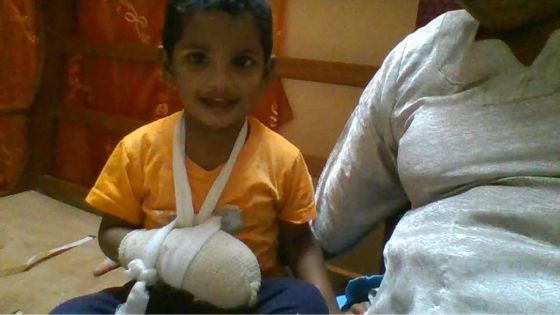 Son bébé brûlé au 3e degré: une famille escroquée de Rs 145 000