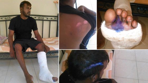 Agression alléguée: un blessé pointe du doigt le personnel du Samu