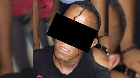 Vente de CD piratés: 4 «bouncers» arrêtés après une altercation avec des marchands