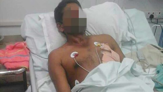 À Lallmatie, dimanche soir: un maçon agressé à coups de tournevis