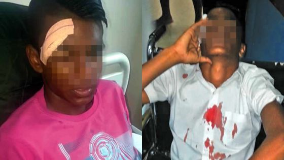 À Plaine-Verte: agression sauvage d’un collégien par un chauffeur de van