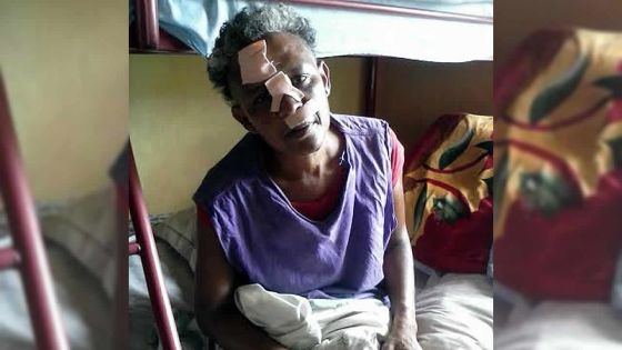 Pour une histoire d’héritage: elle est rouée de coups de poing américain et échappe à la mort