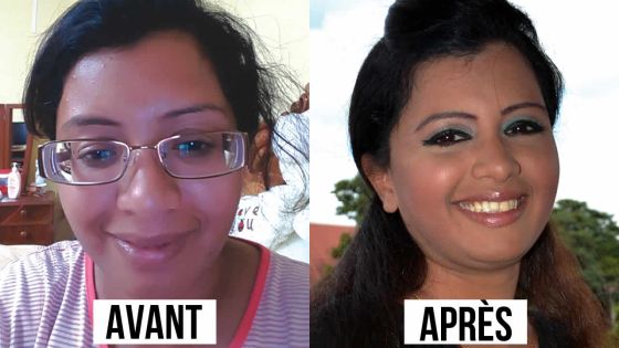 Ses lunettes épaisses lui ont gâché la vie - Parveen Oozeer: «Je me sens à nouveau femme»