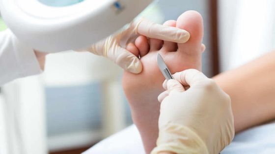 Soins: ne courez pas le risque de négliger vos pieds