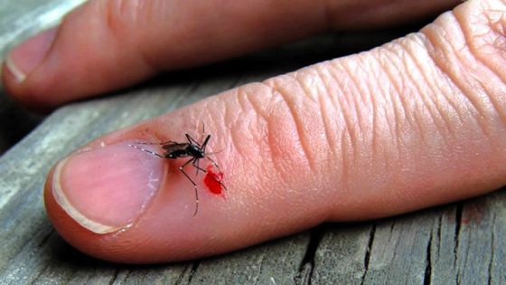 Astuce de grand-mère: Soulagez les piqûres de moustiques