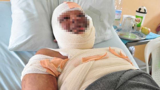 À Forest Side: il se brûle en nettoyant les vitres de sa cuisine