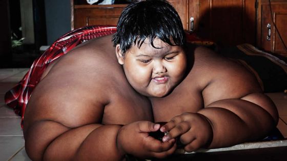 À 10 ans, il pèse 192 kilos