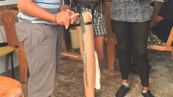 Diabète: 75% des amputations peuvent être prévenues