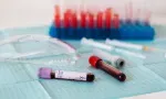 Cas suspect de Mpox : un sexagénaire placé en isolement à l’hôpital du Nord