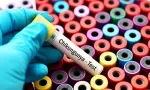 Chikungunya : les États-Unis placent Maurice sous surveillance sanitaire