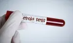 Santé : douze personnes en quarantaine dans le cadre des mesures préventives contre Ebola 