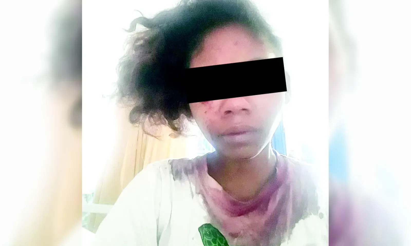 Davina, blessée par sa voisine.