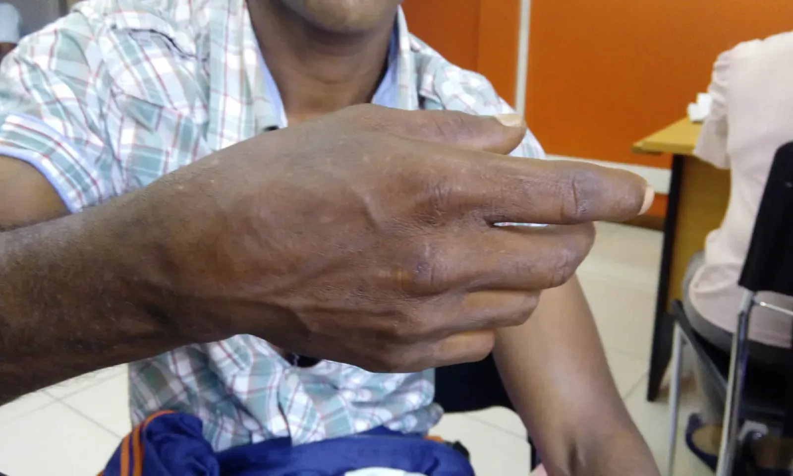 Handicapés : ils lancent un appel au ministre de la Sécurité sociale