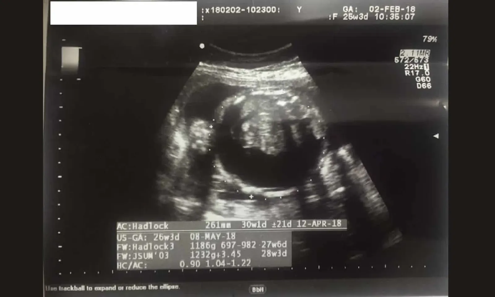 négligence médicale