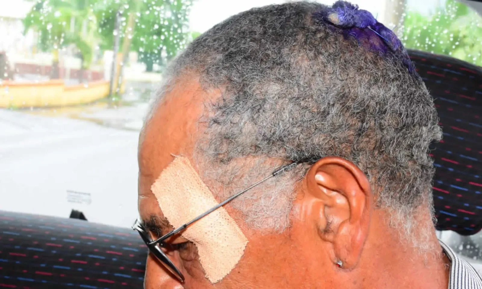 Le maçon a reçu de violents coups à la tête et au visage.