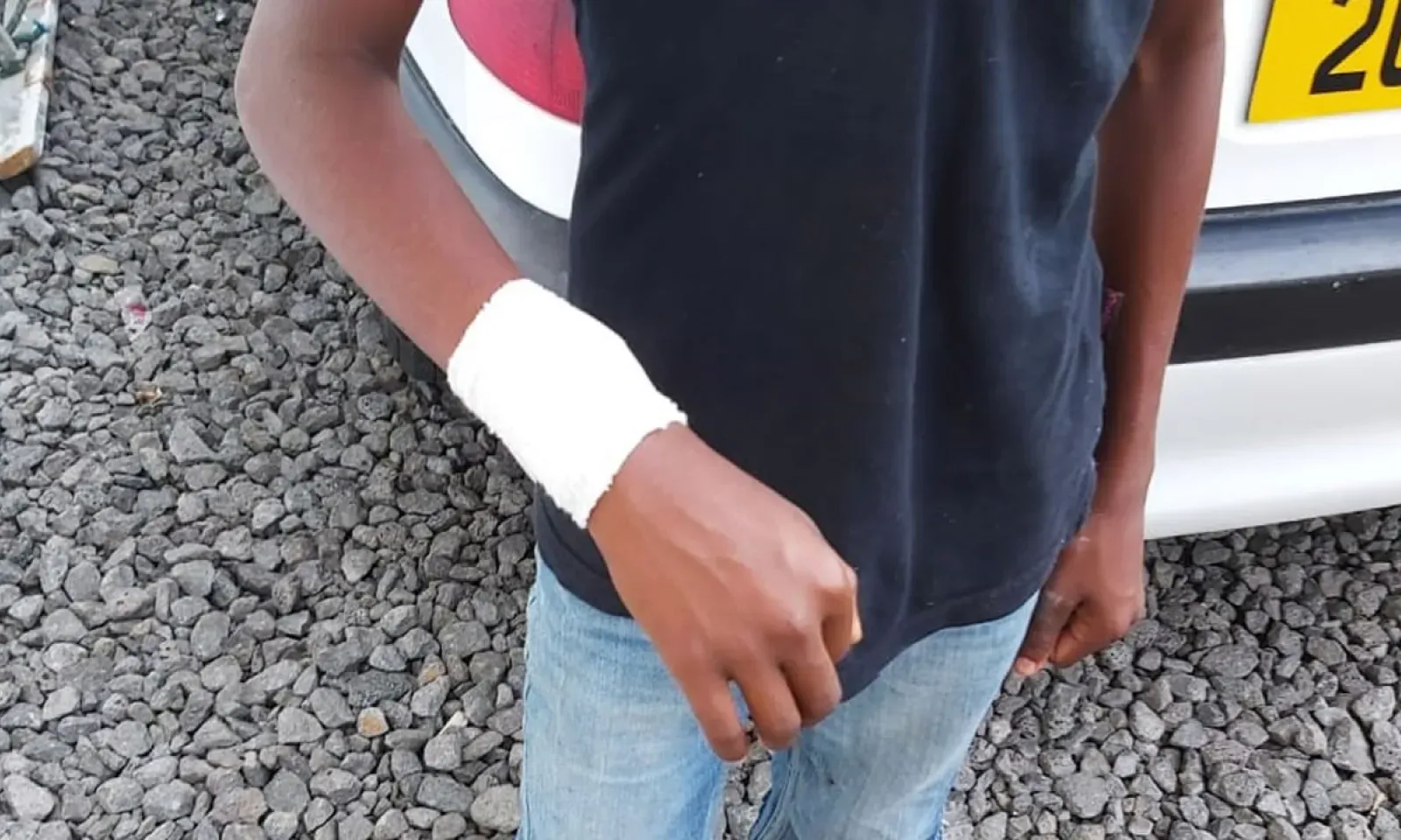 Mujaheed raconte que son père l'a blessé au bras droit avec un couteau de cuisine.