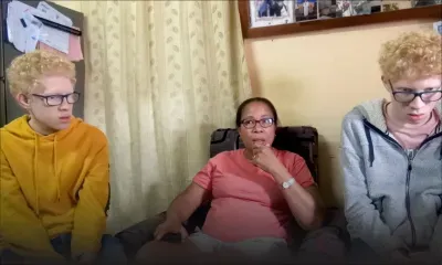 Mère de jumeaux albinos : Parcours d’amour d’une battante 