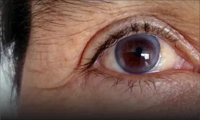 Hôpital de Moka : faute de médecin, une personne âgée ne peut être opérée 