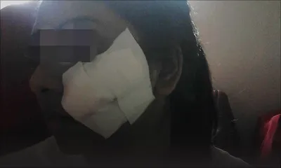 Tailladée au visage - Nisha: «Mo ex ti menas pou fer sa kan nou finn separe»