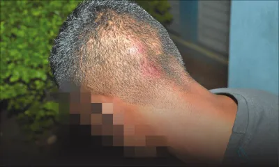 Liaison avec l’épouse de son patron: Fadil est agressé et perd son job