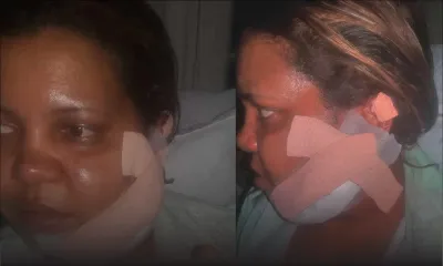 Elle tchatte sur Facebook : son époux lui taillade le visage