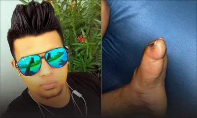 Allégations de négligence médicale : il dit souffrir d’un handicap suivant une opération