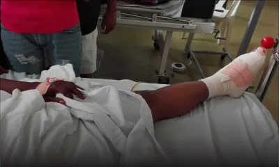 À Bambous : une receveuse a le pied écrasé en tombant d’un bus