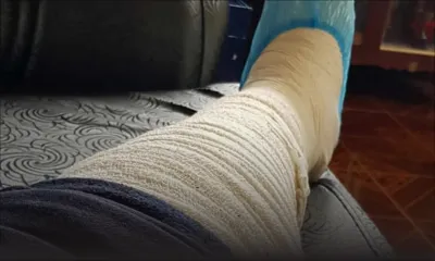 Dans la capitale : un jeune est agressé à coups de machette