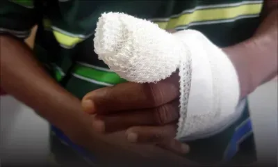 Amputé au niveau du doigt sur son lieu de travail, il est licencié