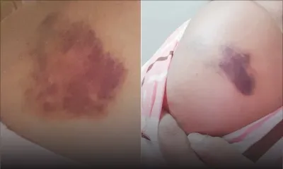 Maltraitance - De l’enfer du mariage arrangé à la violence conjugale : le combat de Shalinee