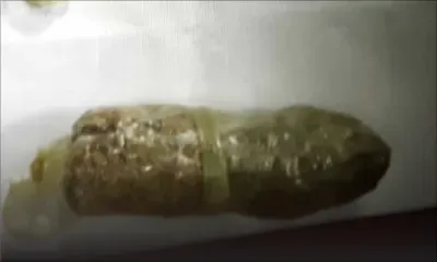 De l’héroïne valant Rs 3,2 M saisie : la passeuse malgache et un chauffeur de taxi arrêtés