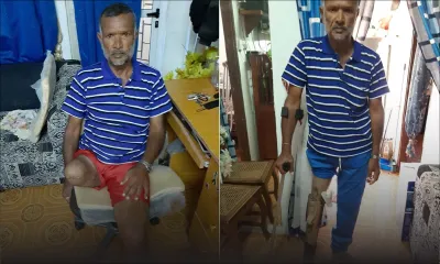 Poochandsing Parmessur : le combat d’un amputé au quotidien